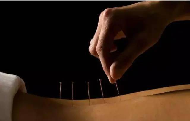 平衡針灸最新視頻，現(xiàn)代應(yīng)用探索針灸藝術(shù)的新境界