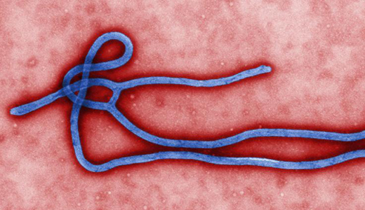 警惕最新病毒病人，你需要了解這些關(guān)鍵信息！