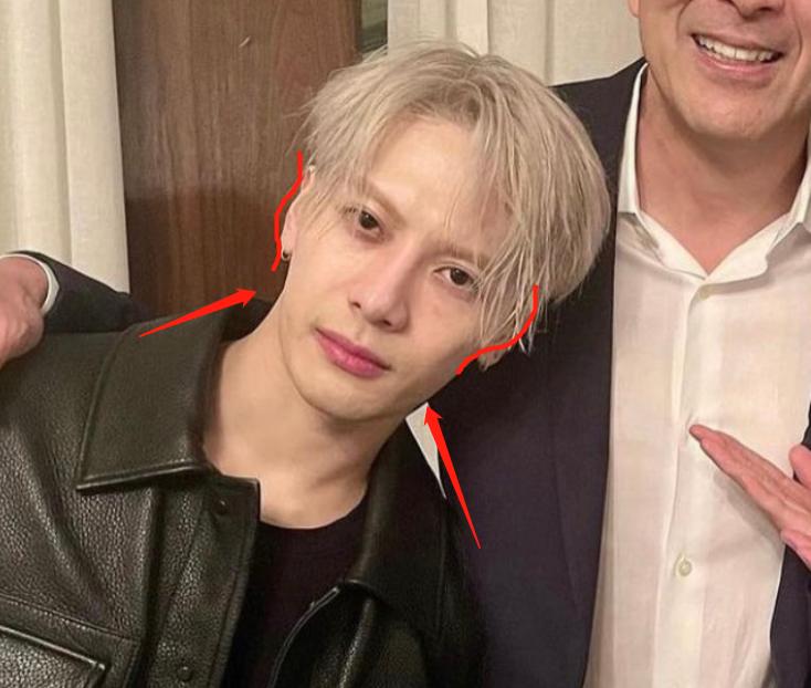 深度解析明星整容后遺癥，觀點(diǎn)與影響探討