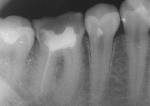 中國再生牙齒研究新進(jìn)展，重塑微笑，科技引領(lǐng)牙齒再生新篇章